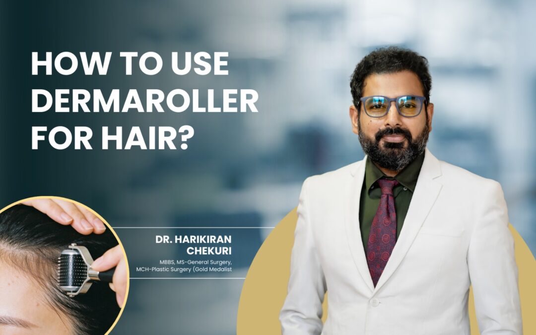 How to Use Dermaroller for Hair ?