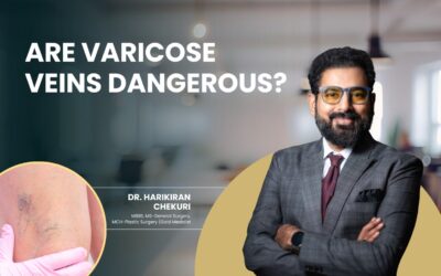 Are Varicose Veins Dangerous?