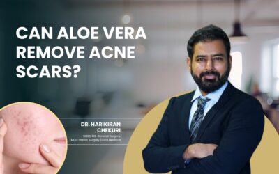 Can Aloe Vera Remove Acne Scar?