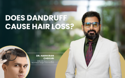 Does Dandruff Cause Hair Loss?