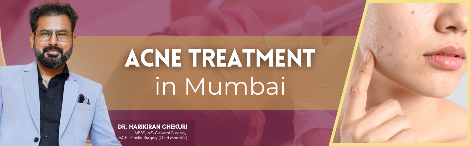 Acne Treatment in Mumbai 