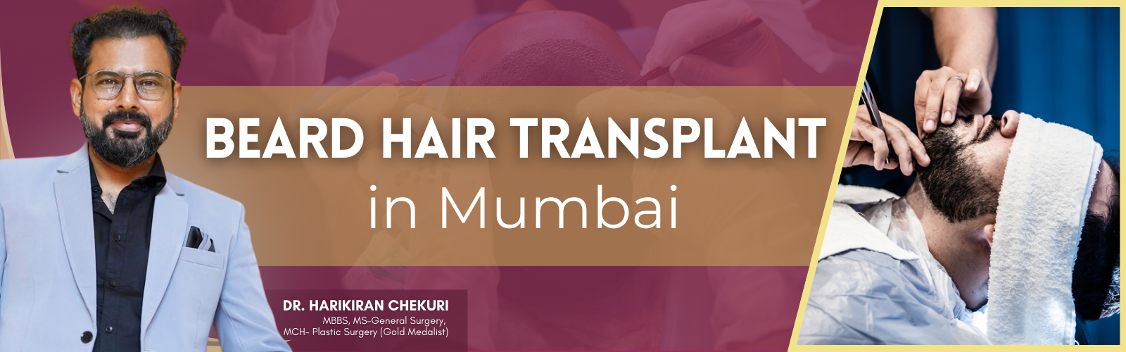 Beard Hair Transplant 