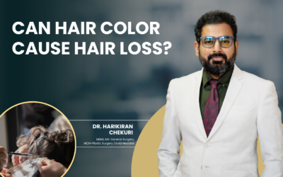Can Hair Color Cause Hair Loss?