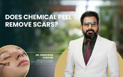 Does Chemical Peel Remove Scars?