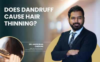 Does Dandruff Cause Hair Thinning?