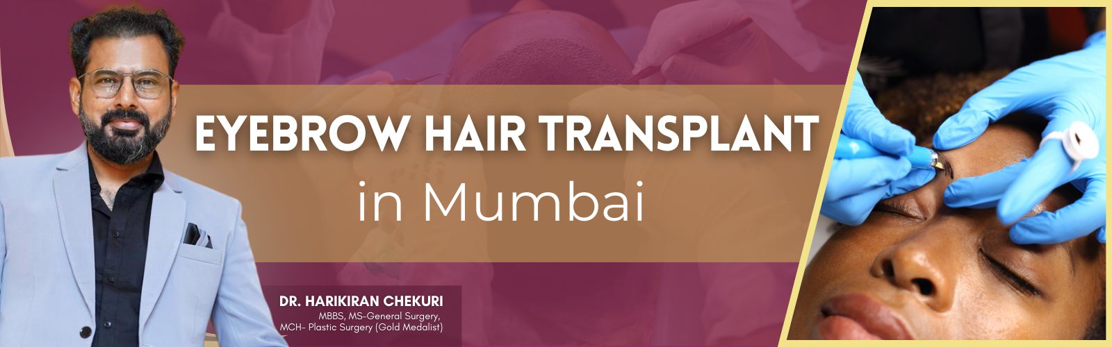 Eyebrow Hair Transplant in Mumbai 