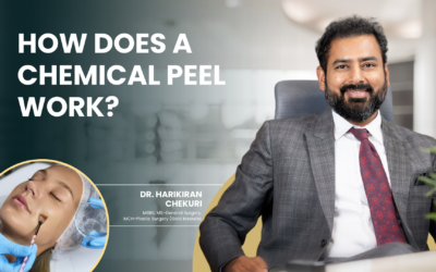 How Does a Chemical Peel Work?