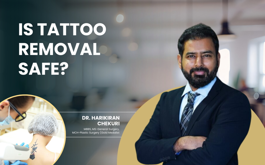 Is Tattoo Removal Safe?