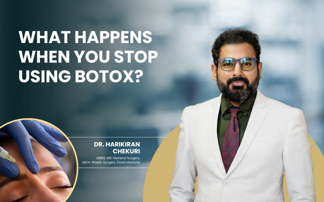 What Happens When You Stop Using Botox?
