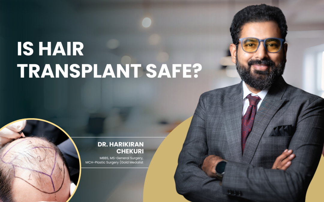 Is Hair Transplant Safe?