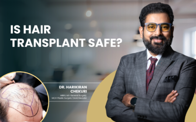Is Hair Transplant Safe?