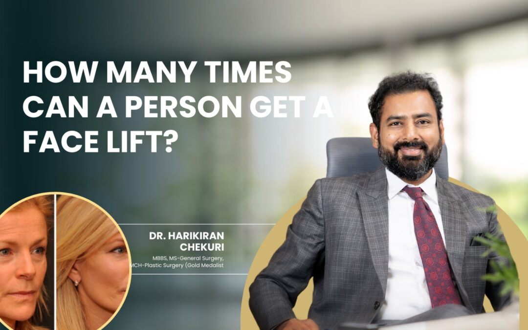 How Many Times Can a Person Get a Face Lift?