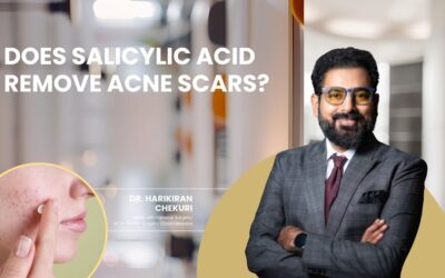 Does Salicylic Acid Remove Acne Scars?