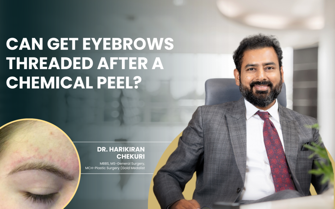 Can Get Eyebrows Threaded After a Chemical Peel?