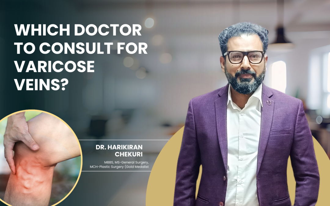 Which Doctor to Consult for Varicose Veins?