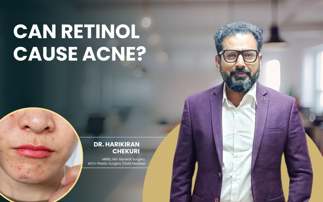 Can Retinol Cause Acne?
