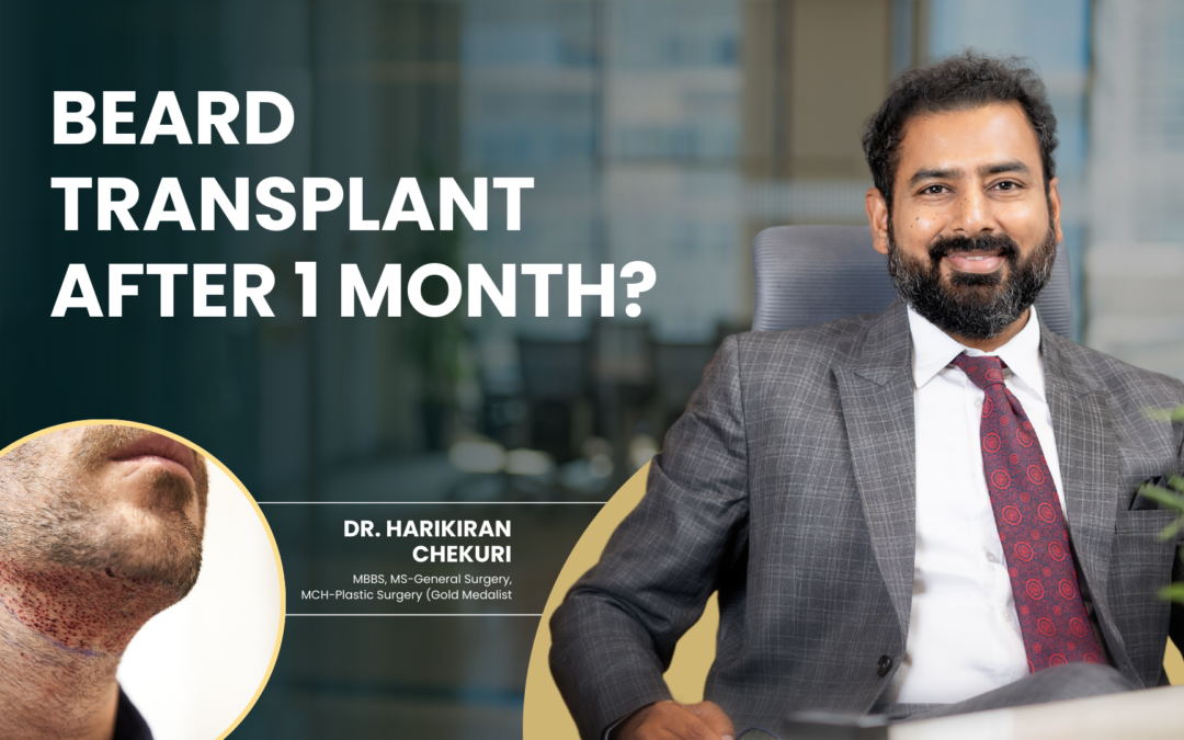 Beard Transplant After 1 Month?
