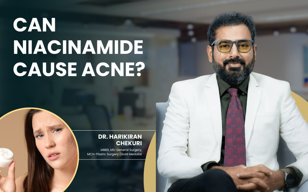 Can Niacinamide Cause Acne?