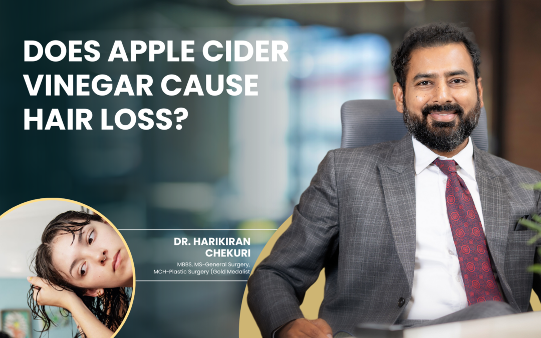Does Apple Cider Vinegar Cause Hair Loss?