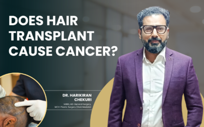 Does Hair Transplant Cause Cancer?