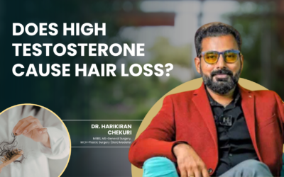 Does High Testosterone Cause Hair Loss?