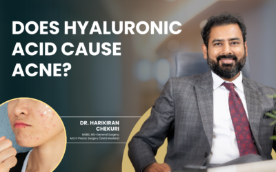 Does Hyaluronic Acid Cause Acne?