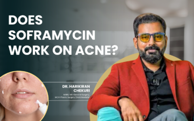 Does Soframycin Work on Acne?
