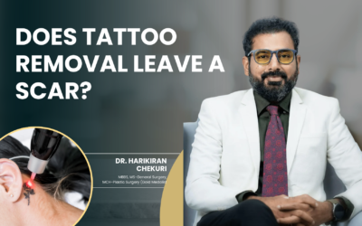 Does Tattoo Removal Leave a Scar?