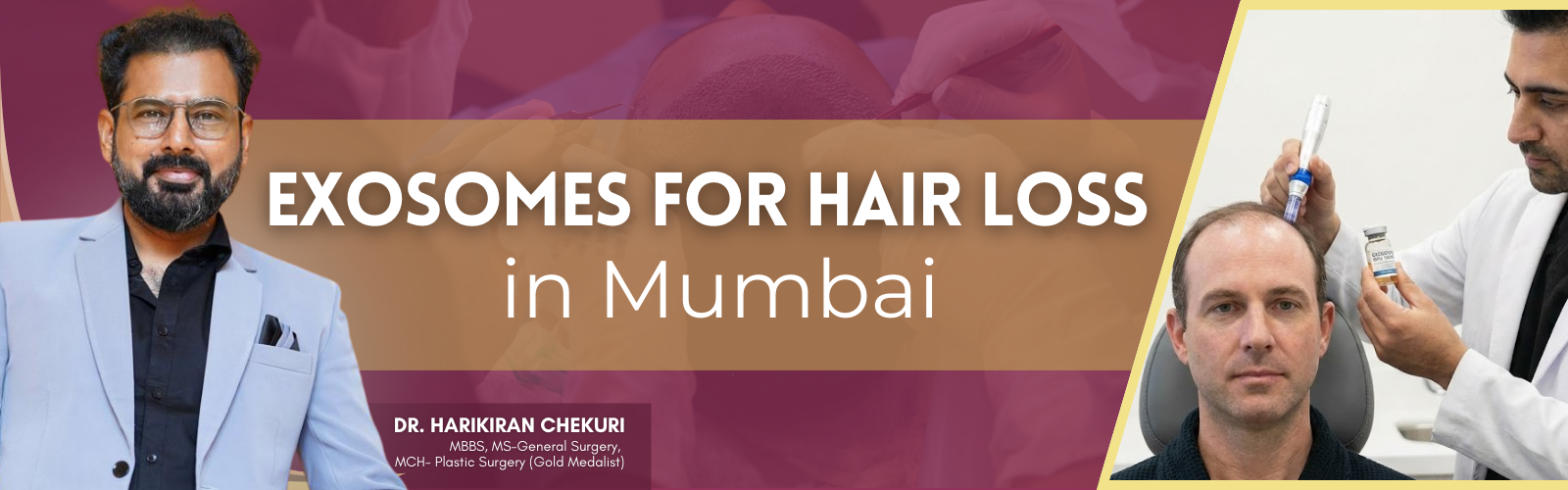 Eyebrow Hair Transplant in Mumbai 