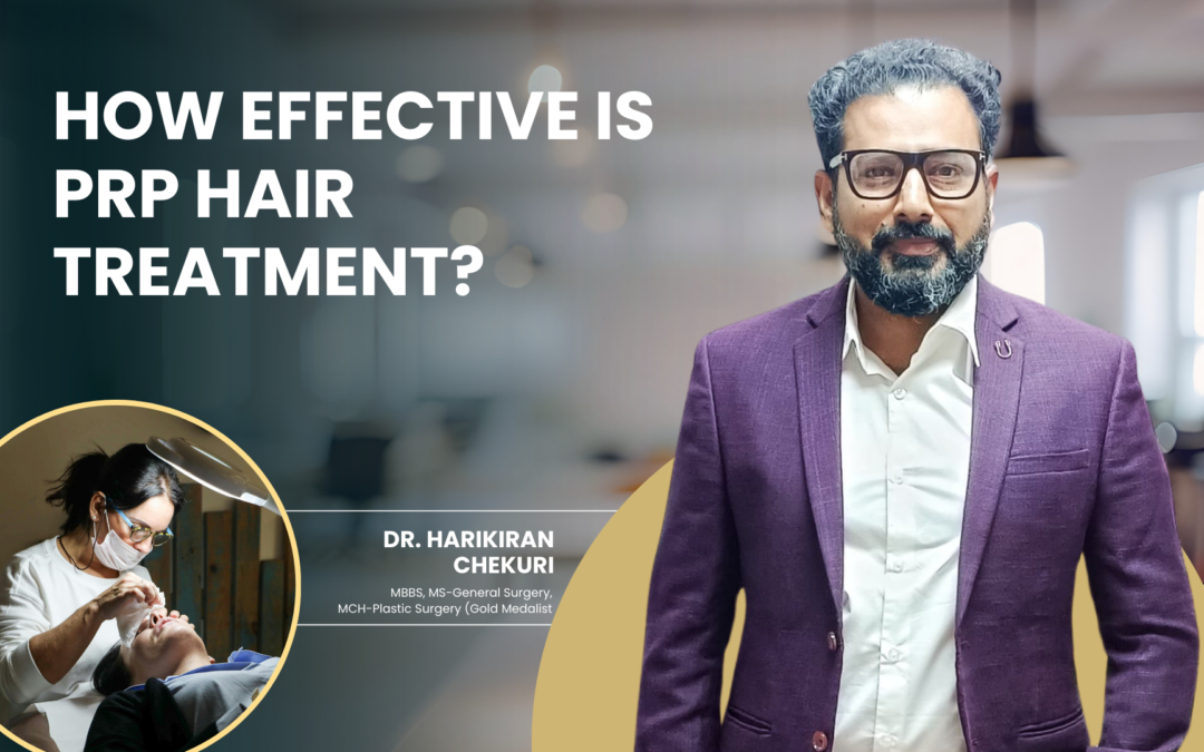 How Effective Is PRP Hair Treatment?