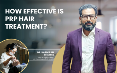 How Effective Is PRP Hair Treatment?