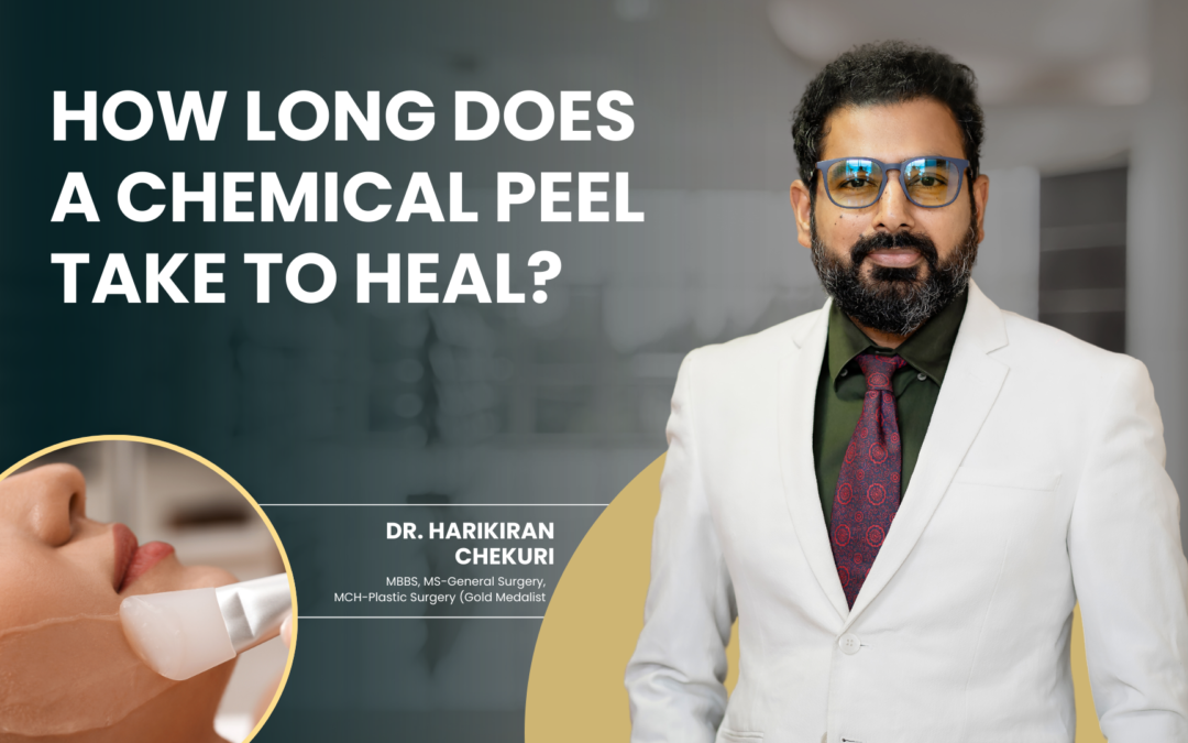 How Long Does a Chemical Peel Take to Heal?