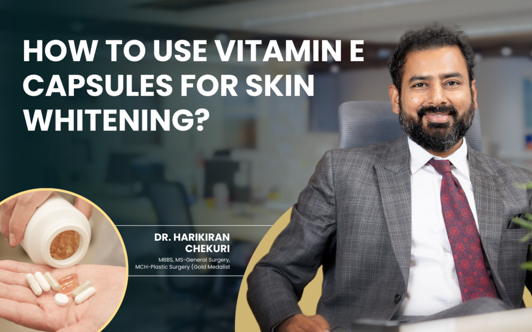 How to Use Vitamin E Capsules for Skin Whitening?