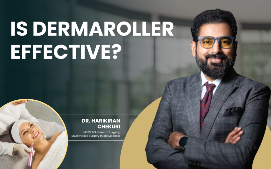 Is Dermaroller Effective?