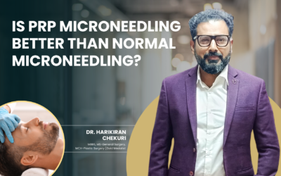 Is PRP Microneedling Better Than Normal Microneedling?