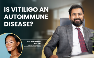Is Vitiligo an Autoimmune Disease?