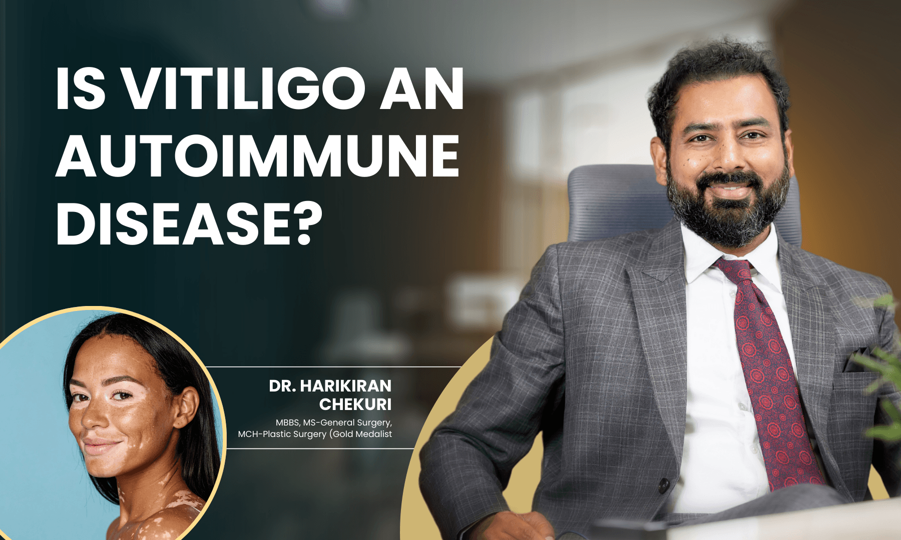 Best Vitiligo Treatment Options in India - Dr. Harikiran Chekuri