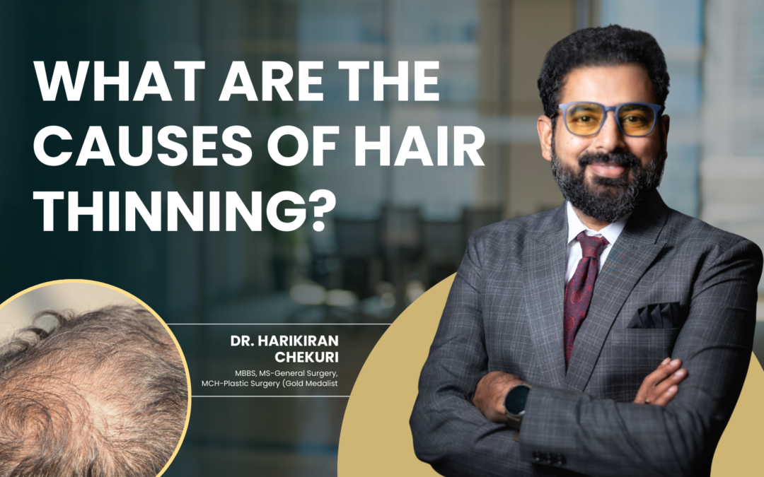 What Are the Causes of Hair Thinning?