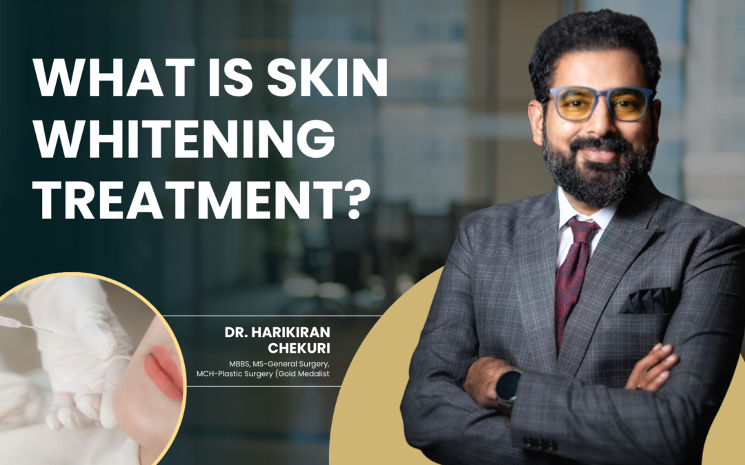 What Is Skin Whitening Treatment?