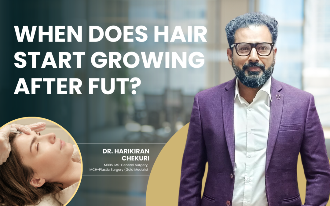 When Does Hair Start Growing After FUT?