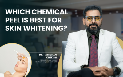 Which Chemical Peel Is Best for Skin Whitening?