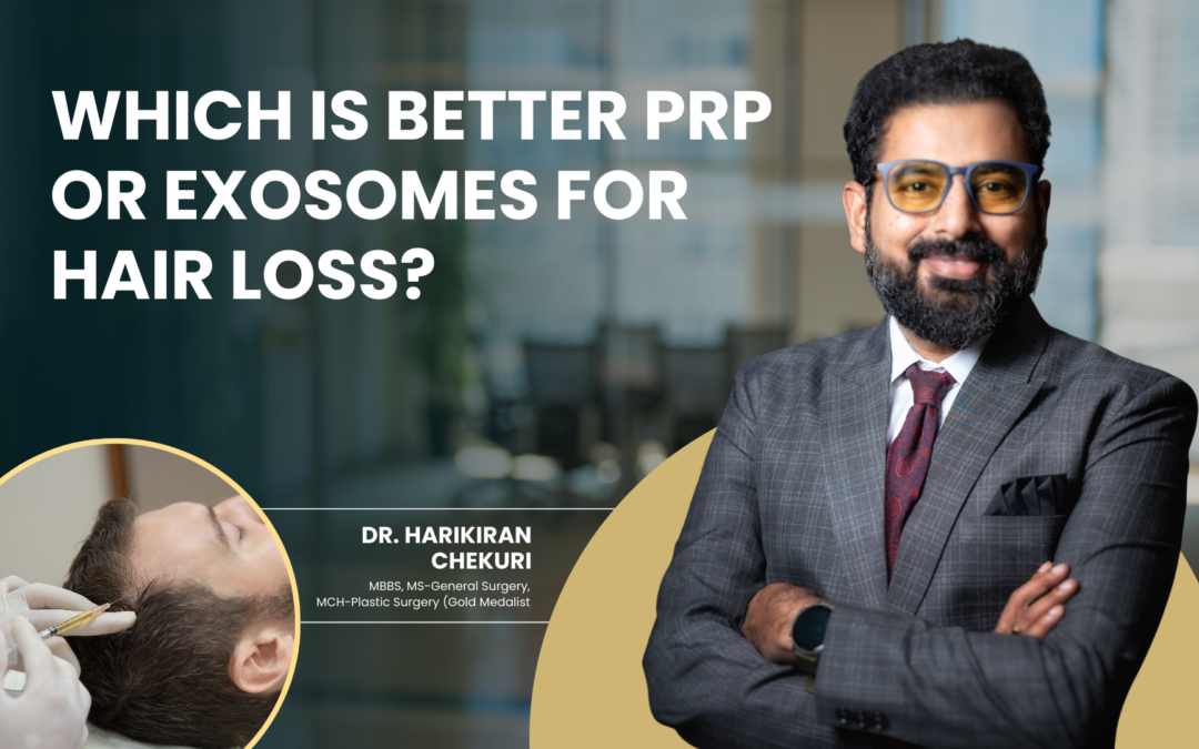 Which is Better PRP or Exosomes for Hair Loss?