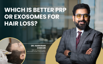 Which is Better PRP or Exosomes for Hair Loss?