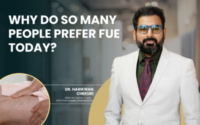 Why Do So Many People Prefer FUE Today?