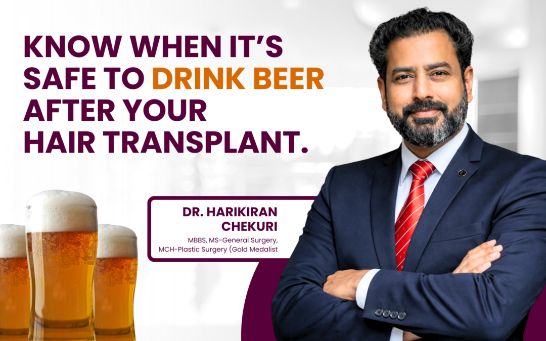 Can I Drink Beer After Hair Transplant?