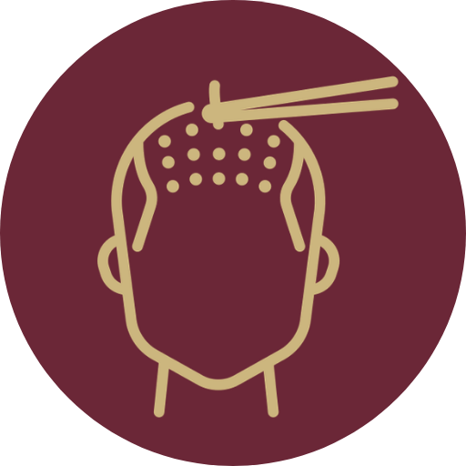 Advanced FUE hair transplant | Redefine FUE Hair Transplant