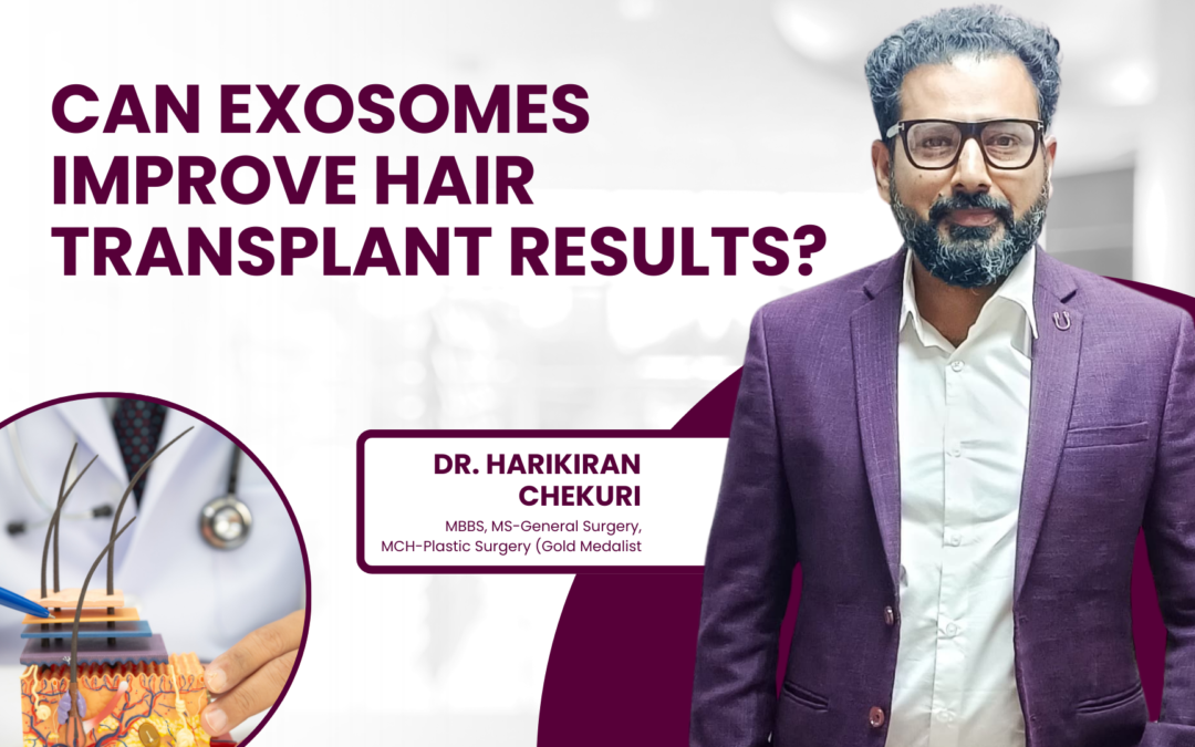 Can Exosomes Improve Hair Transplant Results?