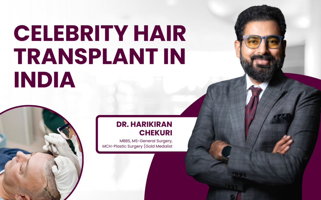 Celebrity Hair Transplant in India
