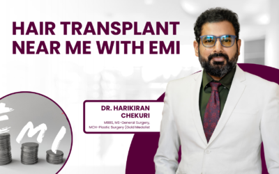 Hair Transplant Near Me With EMI