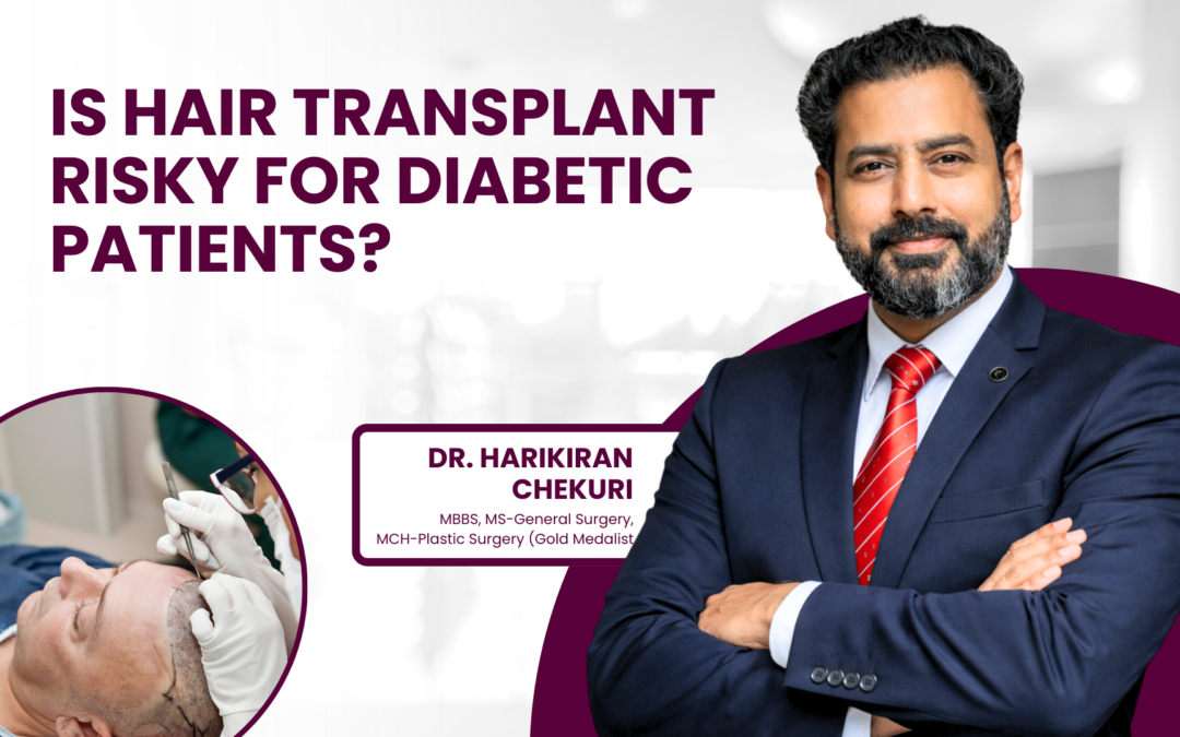 Is Hair Transplant Risky for Diabetic Patients?